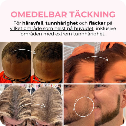 LAMORi Beauty™ - Hårlinjepuder